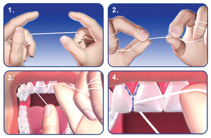 underkjole hente sensor Right Way to Flossing | The Dental Arcade – Blog