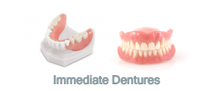 immediate-dentures-300x133