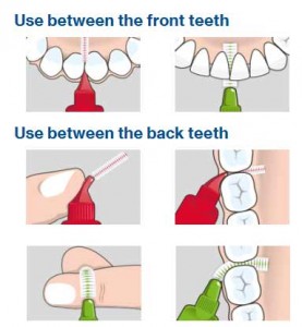 Tepe_Usage_Instructions