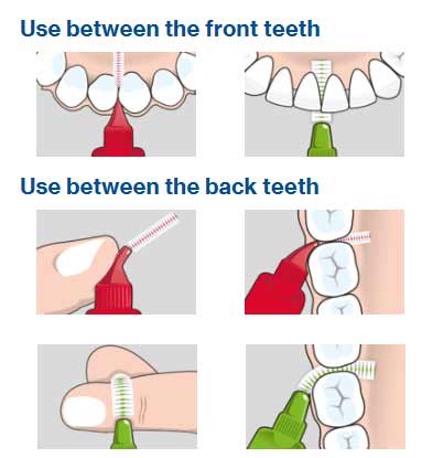Brush Back Teeth