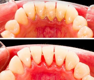 scaling-before-after