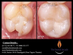 47 tooth final