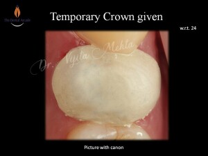 Slide12