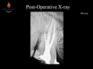 Slide10