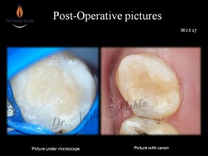 Slide11