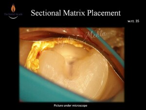 Slide11
