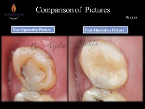 Slide13