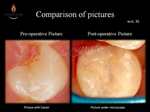 Slide14