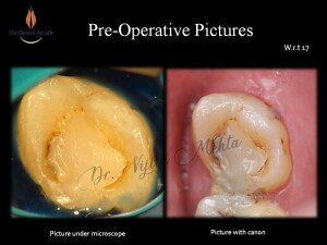 Slide2