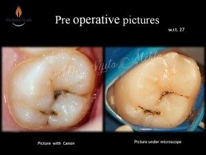 Slide2