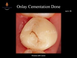 Slide21