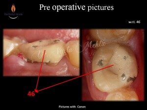 Slide2