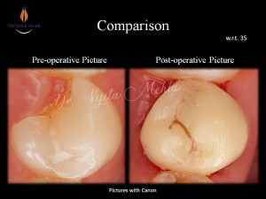 Slide22