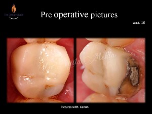 Slide2