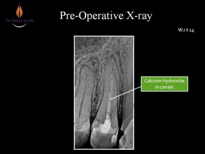 Slide3