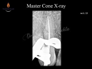 Slide4