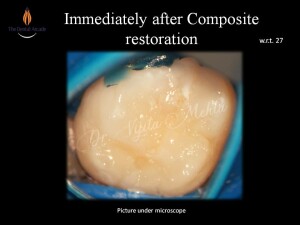 Slide5
