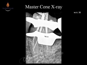 Slide5