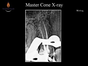 Slide5