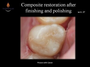 Slide6