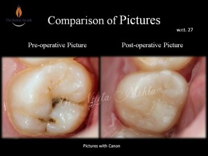 Slide7