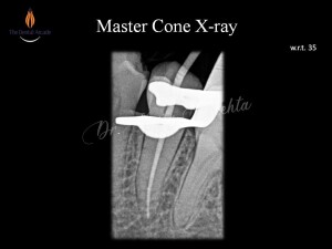 Slide8