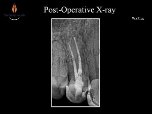 Slide8