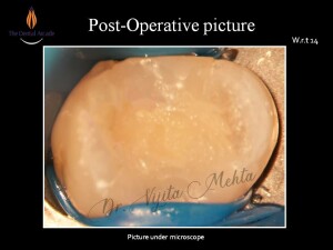 Slide9