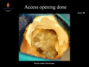 Slide6