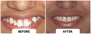 Smile Gallery