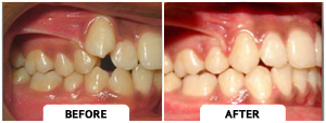 Smile Gallery