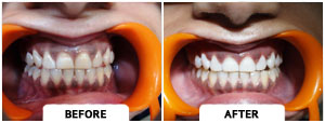 Smile Gallery