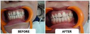 Smile Gallery