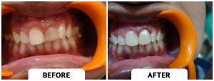 Smile Gallery