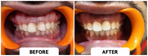 Smile Gallery