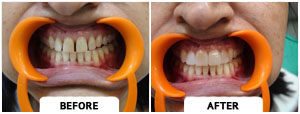 Smile Gallery