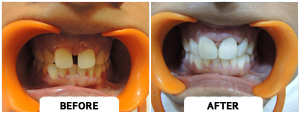 Smile Gallery